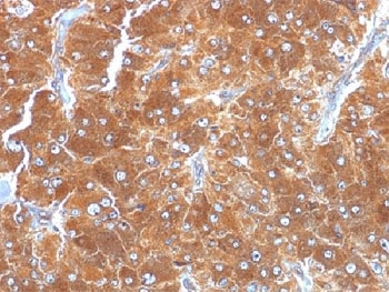 ADRP Antibody / Adipophilin / Perilipin 2 / PLIN2