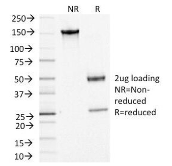 ACTH Antibody / CLIP