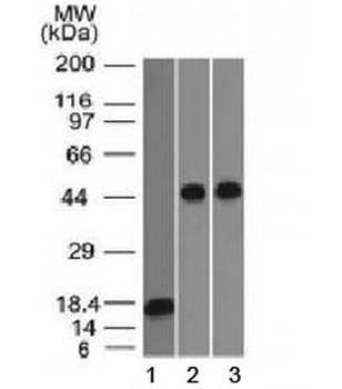 Alpha 1 Antitrypsin Antibody (Hepatocyte Marker)