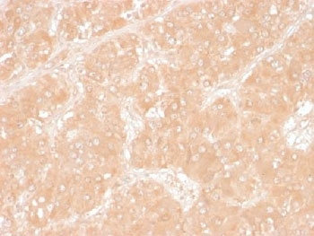 Perilipin 2 Antibody / Adipophilin / ADRP