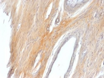 Caldesmon / CAD Antibody HMW