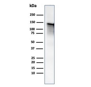 Caldesmon / CAD Antibody HMW