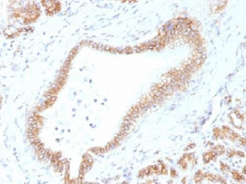 Beta Catenin Antibody