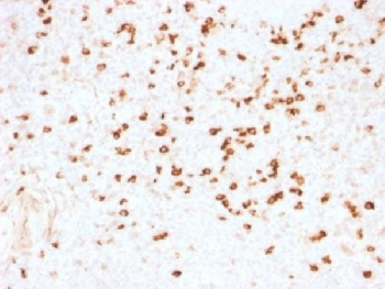 Lambda Light Chain Antibody