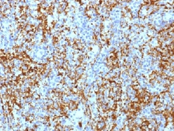 Integrin beta 3 Antibody / CD61 / ITGB3