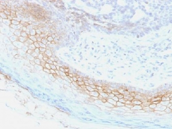 Desmocollin 2/3 Antibody