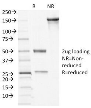 Desmocollin 2/3 Antibody