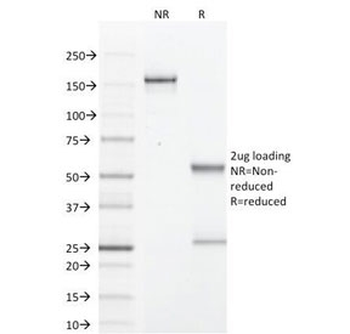 GCDFP-15 Antibody / PIP / Prolactin-Induced Protein