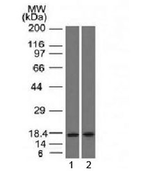 PIP Antibody / Prolactin Inducible Protein / GCDFP-15