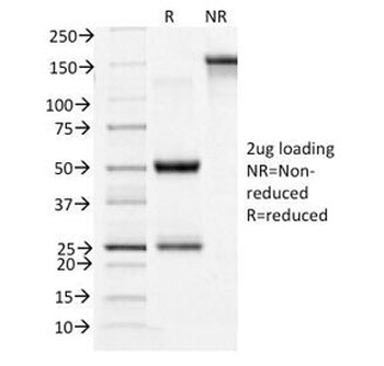 CD71 Antibody / Transferrin Receptor