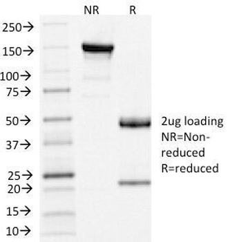 Clathrin Light Chain Antibody