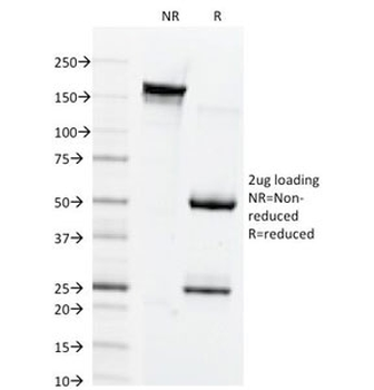Connexin 32 Antibody / GJB1