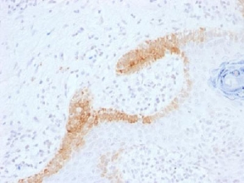 Cytokeratin 15 Antibody