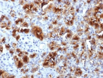 GP2 Antibody / Glycoprotein 2 / ZAP75