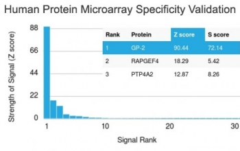 GP2 Antibody / Glycoprotein 2 / ZAP75