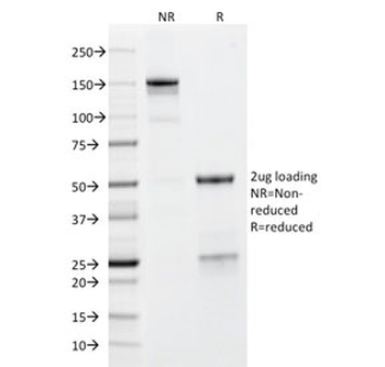 GP2 Antibody / Glycoprotein 2 / ZAP75
