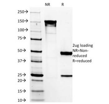 DOG1 Antibody