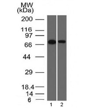 Endoglin Antibody / CD105