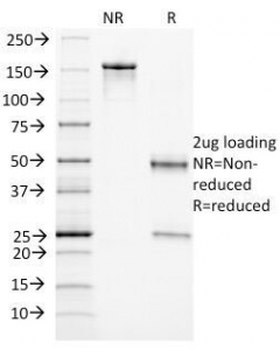Endoglin Antibody / CD105
