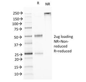 TNFSF15 Antibody / VEGI / TL1A