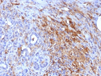 Ferritin Light Chain Antibody