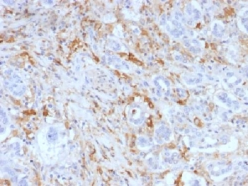 FTL Antibody / Ferritin light chain