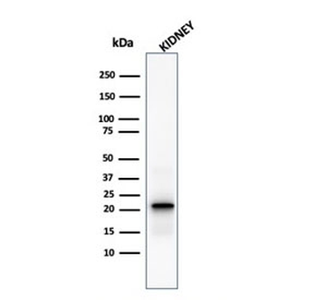 FTL Antibody / Ferritin light chain