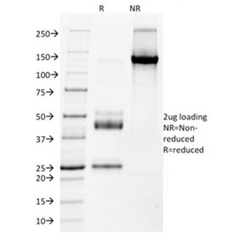 NKX2.2 Antibody