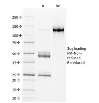 HLA-DP/DQ/DR Antibody (MHC II)