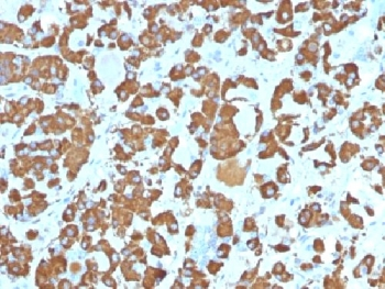 Growth Hormone Antibody (pituitary)