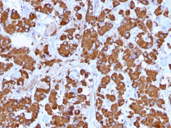 Growth Hormone Antibody / GH1