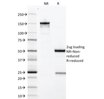 Growth Hormone Antibody / GH1