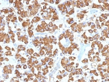 GH Antibody (pituitary) / Growth Hormone