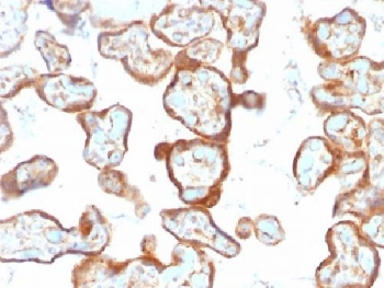 Thymidine Phosphorylase Antibody / PD-ECGF