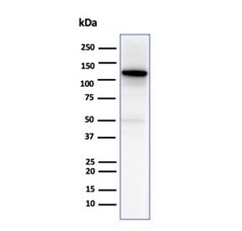 N-Cadherin Antibody / CDH2