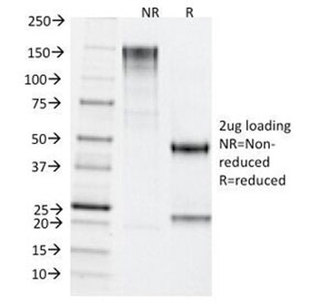 TDP2 Antibody / ETS1 associated protein II