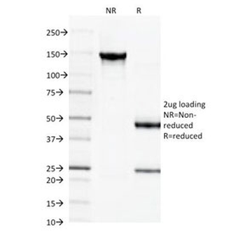 SPTBN2 Antibody / Spectrin beta III