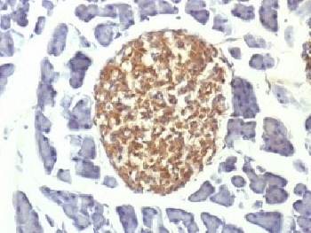 NSE Antibody / Neuron Specific Enolase
