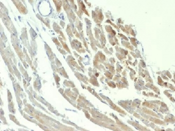 NSE Antibody / Neuron Specific Enolase