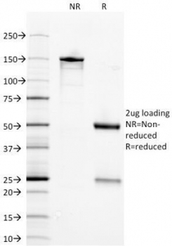 NSE Antibody / Neuron Specific Enolase