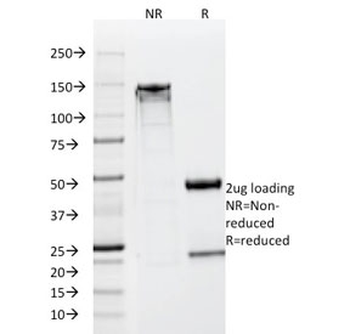 NSE Antibody / Neuron Specific Enolase