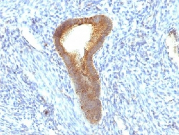 Tissue-nonspecific Alkaline Phosphatase Antibody / ALPL