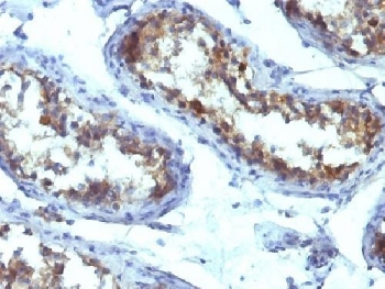 Tissue-nonspecific Alkaline Phosphatase Antibody / ALPL