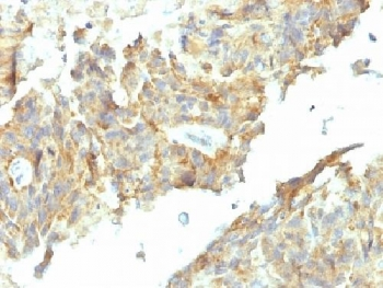 Tissue-nonspecific Alkaline Phosphatase Antibody / ALPL