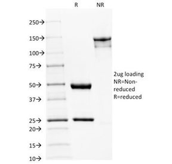 SPTBN2 Antibody / Spectrin beta III
