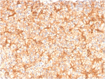SPTBN2 Antibody / Spectrin beta III