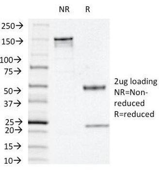 Thymidine Phosphorylase Antibody / PD-ECGF