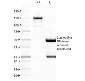von Willebrand Factor Antibody / vWF