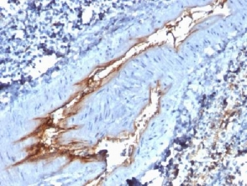 vWF Antibody