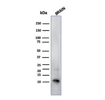 S100B Antibody